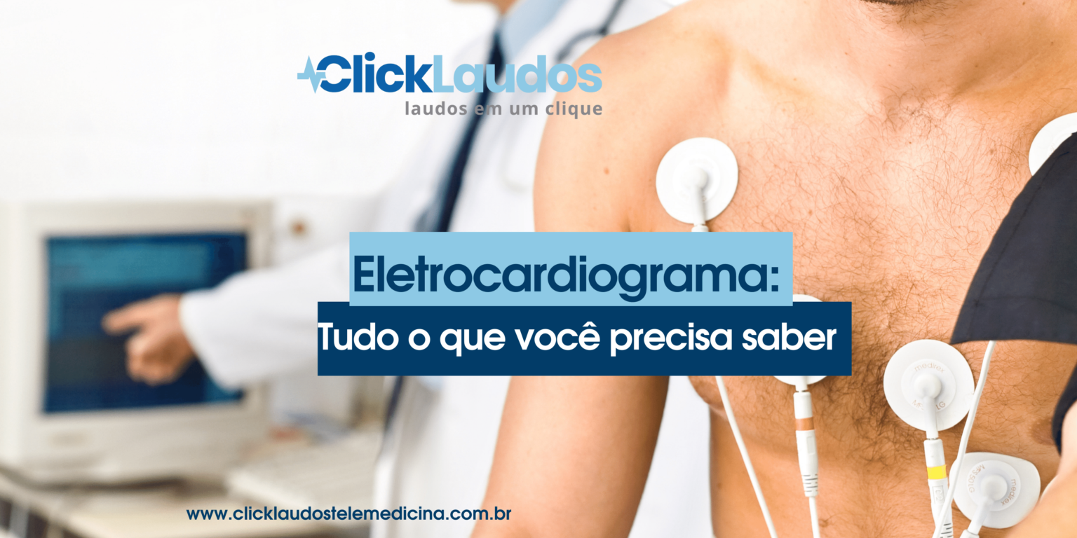 Tudo Sobre Eletrocardiograma O Mais Antigo Método De Diagnóstico De